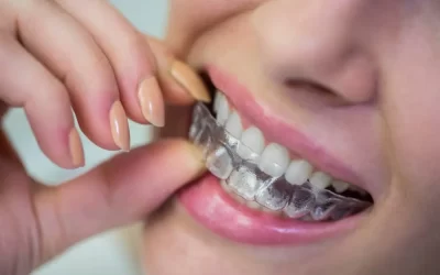 Your Brights Grove Dentist Breaks Down the Differences Between Braces and Invisalign