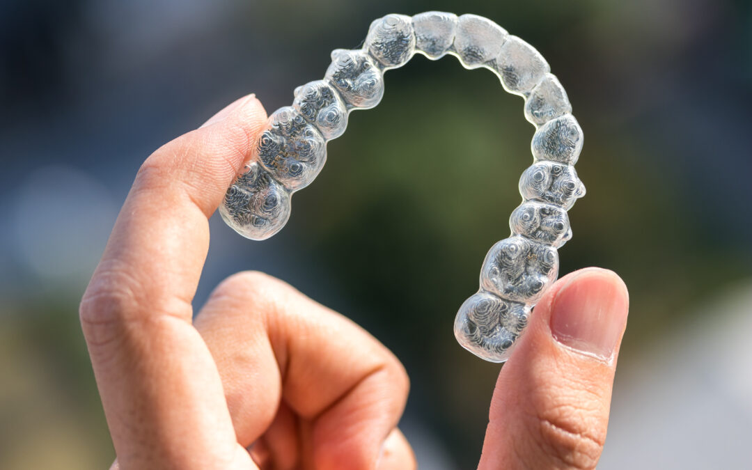 Top Signs You Might Need Invisalign