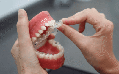 How Often Do You Need Invisalign Checkups?
