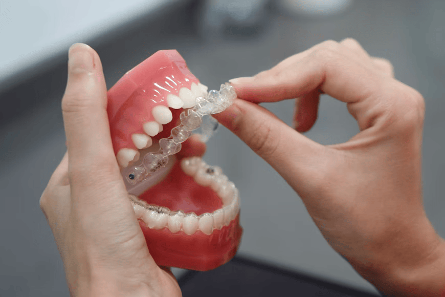 How Often Do You Need Invisalign Checkups?