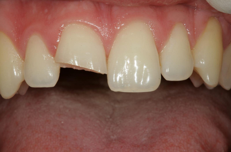 dentist in Brights Grove